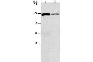 Western Blot analysis of A172 and PC3 cell using ACLY Polyclonal Antibody at dilution of 1:1050 (ACLY antibody)