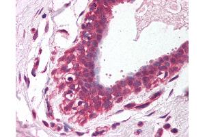 Anti-ETV4 / PEA3 antibody IHC of human breast. (ETV4 antibody  (AA 181-230))