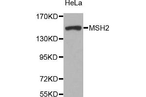 Western blot analysis of extracts of HeLa cell line, using MSH2 antibody. (MSH2 antibody)