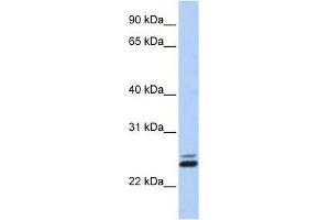 JAZF1 antibody used at 0.