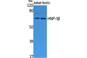 Western Blotting (WB) image for anti-HNF1 Homeobox B (HNF1B) (N-Term) antibody (ABIN3187643) (HNF1B antibody  (N-Term))