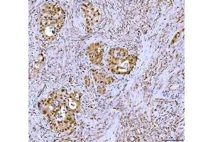 IHC analysis of Symplekin/SYMPK using anti-Symplekin/SYMPK antibody (ABIN7601558). (Symplekin antibody  (AA 384-1092))