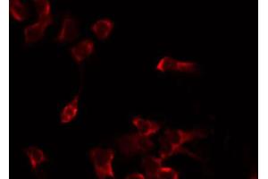 ABIN6274821 staining Hela by IF/ICC. (AGXT2L2 antibody  (C-Term))