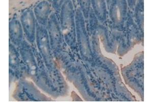 Detection of RARa in Mouse Intestine Tissue using Polyclonal Antibody to Retinoic Acid Receptor Alpha (RARa) (Retinoic Acid Receptor alpha antibody  (AA 237-459))