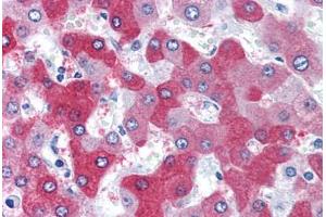 Human Liver (formalin-fixed, paraffin-embedded) stained with FTCD antibody ABIN351476 at 3. (FTCD antibody  (AA 2-17))