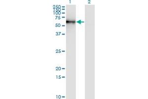 Western Blot analysis of STK33 expression in transfected 293T cell line by STK33 monoclonal antibody (M06), clone 4F7. (STK33 antibody  (AA 1-514))