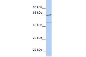 WB Suggested Anti-CCDC74A Antibody Titration: 0. (CCDC74A antibody  (Middle Region))
