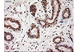 Immunohistochemical staining of paraffin-embedded breast using anti-NTF4 (ABIN2452547) mouse monoclonal antibody. (Neurotrophin 4 antibody  (AA 81-210))