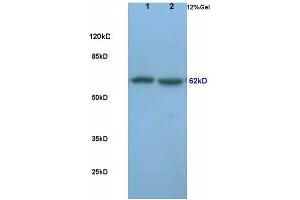 L1 rat lung lysates, L2 rat brain lysates probed (ABIN681853) Anti-Frizzled-5 Polyclonal, Unconjugated at 1:200 in 4 °C. (Frizzled5/8 antibody  (AA 51-150))