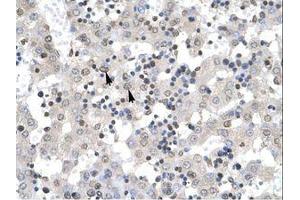 Image no. 1 for anti-Zinc Finger Protein 654 (ZNF654) (AA 289-338) antibody (ABIN6735934) (ZNF654 antibody  (AA 289-338))