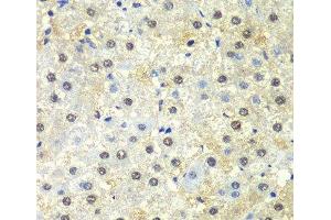 Immunohistochemistry of paraffin-embedded Human liver damage using PSMD13 Polyclonal Antibody at dilution of 1:100 (40x lens). (PSMD13 antibody)
