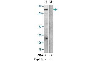 Western blot analysis of extracts from HUVEC cells, treated with PMA (125 ng/mL, 30 mins), using PRKD1 polyclonal antibody . (PKC mu antibody  (Ser205))