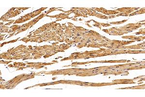 Detection of SOD1 in Mouse Cardiac Muscle Tissue using Polyclonal Antibody to Superoxide Dismutase 1 (SOD1) (SOD1 antibody  (AA 2-154))