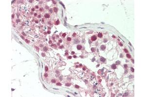 Human Testis: Formalin-Fixed, Paraffin-Embedded (FFPE). (Retinoic Acid Receptor gamma antibody  (AA 143-192))