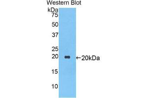 Western Blotting (WB) image for anti-serpin Peptidase Inhibitor, Clade A (Alpha-1 Antiproteinase, Antitrypsin), Member 1 (SERPINA1) (AA 27-181) antibody (ABIN1077773) (SERPINA1 antibody  (AA 27-181))