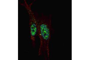 Fluorescent confocal image of SY5Y cells stained with STAT3 (C-term ) antibody. (STAT3 antibody  (C-Term))