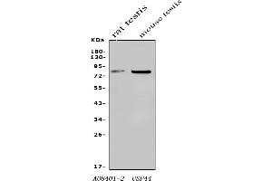 Western blot analysis of USP44 using anti-USP44 antibody (ABIN7600640).