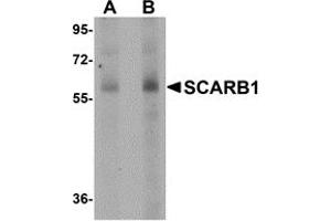 Western Blotting (WB) image for anti-Scavenger Receptor Class B, Member 1 (SCARB1) (N-Term) antibody (ABIN1031556) (SCARB1 antibody  (N-Term))