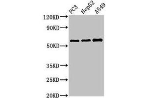 Western Blot Positive WB detected in: PC-3 whole cell lysate, HepG2 whole cell lysate, A549 whole cell lysate All lanes: vnn1 antibody at 3. (VNN1 antibody  (AA 97-197))