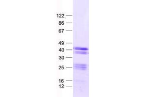 Validation with Western Blot (LUZP4 Protein (His tag))