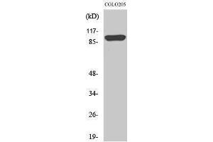 Western Blotting (WB) image for anti-Proteasome (Prosome, Macropain) 26S Subunit, Non-ATPase, 2 (PSMD2) (N-Term) antibody (ABIN3186586) (PSMD2 antibody  (N-Term))