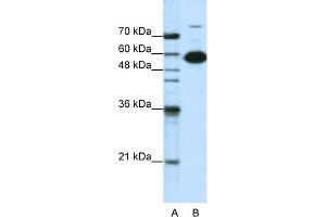 WB Suggested Anti-NONO Antibody Titration:  1. (NONO antibody  (C-Term))