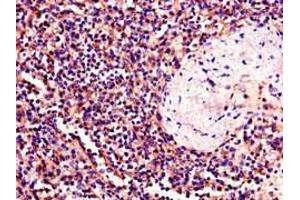 Immunohistochemistry of paraffin-embedded human spleen tissue using ABIN7174011 at dilution of 1:100 (BTK antibody  (AA 254-443))