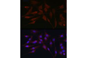 Immunofluorescence (IF) image for anti-Apolipoprotein B mRNA Editing Enzyme, Catalytic Polypeptide-Like 3G (APOBEC3G) (AA 60-330) antibody (ABIN6137010)