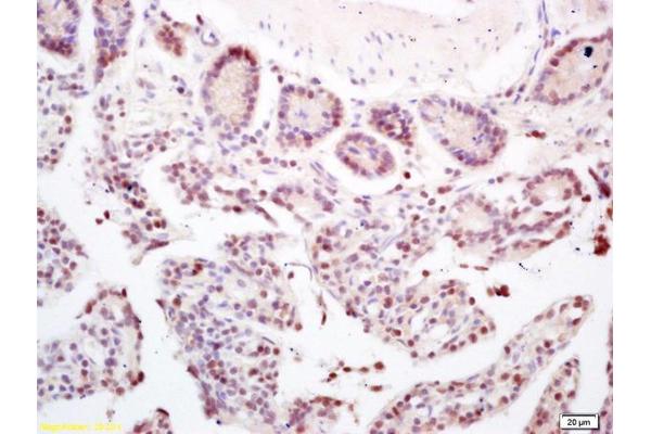CCDC7 antibody  (AA 155-250)