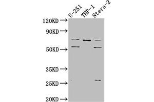 Western Blot Positive WB detected in: U-251 whole cell lysate, THP-1 whole cell lysate, Ntera-2 whole cell lysate All lanes: PTH1R antibody at 1:1000 Secondary Goat polyclonal to rabbit IgG at 1/50000 dilution Predicted band size: 67 kDa Observed band size: 72, 55 kDa (Recombinant PTH1R antibody)