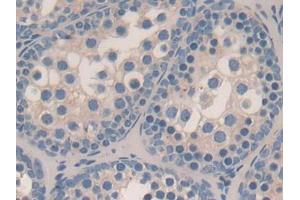 DAB staining on IHC-P; Samples: Mouse Testis Tissue (STAMBP antibody  (AA 166-406))