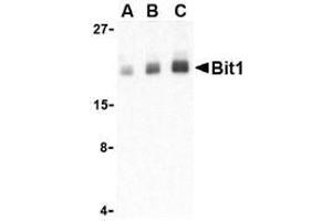 Western blot analysis of Bit1 in Daudi cell lysate with AP30153PU-N Bit1 antibody at (A) 1, (B) 2, and (C) 4 μg/ml. (PTRH2 antibody  (Middle Region))