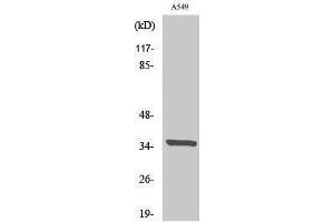 Western Blotting (WB) image for anti-Peroxisomal Biogenesis Factor 2 (PEX2) (N-Term) antibody (ABIN3186404)