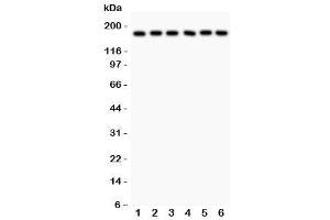 Western blot testing of PAPP-A antibody and human samples 1:  placenta (PAPPA antibody  (AA 95-388))