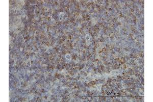 Immunoperoxidase of monoclonal antibody to SH2D3C on formalin-fixed paraffin-embedded human lymph node. (SH2D3C antibody  (AA 1-110))