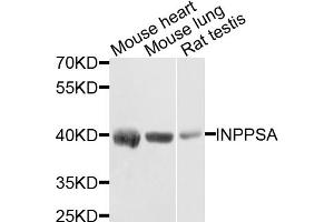 Western blot analysis of extracts of various cell lines, using INPP5A antibody. (INPP5A antibody)