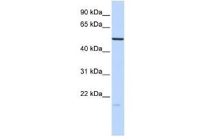 Human Brain; WB Suggested Anti-ZNF773 Antibody Titration: 0. (ZNF773 antibody  (N-Term))