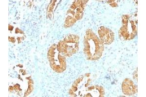 IHC testing of FFPE human rectum tissue with Villin antibody (clone VIL1/1314). (Villin 1 antibody  (AA 179-311))