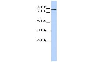 WB Suggested Anti-ZNF366 Antibody Titration:  0.