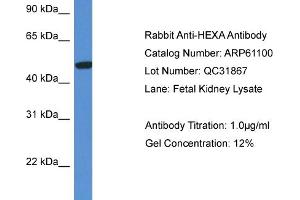 Western Blotting (WB) image for anti-Hexosaminidase A (HEXA) (C-Term) antibody (ABIN786333) (Hexosaminidase A antibody  (C-Term))