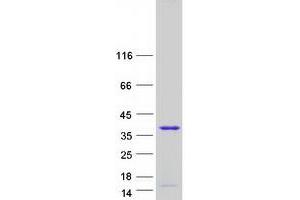 Western Blotting (WB) image for Transcription Elongation Factor A (SII)-Like 3 (TCEAL3) (Transcript Variant 2) protein (Myc-DYKDDDDK Tag) (ABIN2733347)