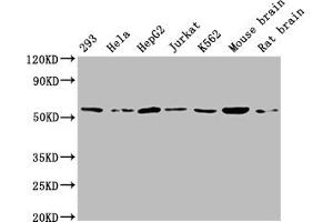 Western Blot Positive WB detected in: 293 whole cell lysate, Hela whole cell lysate, HepG2 whole cell lysate, Jurkat whole cell lysate, K562 whole cell lysate, Mouse brain tissue, Rat brain tissue All lanes: ATP5A1 antibody at 1:2000 Secondary Goat polyclonal to rabbit IgG at 1/50000 dilution Predicted band size: 60, 55, 58 kDa Observed band size: 60 kDa (ATP5F1A (AA 59-257) antibody)
