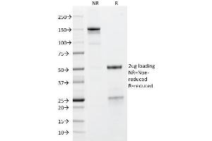 SDS-PAGE Analysis Purified GP2 Mouse Monoclonal Antibody (GP2/1712). (GP2 antibody  (AA 35-179))
