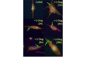 Time course study of mouse leukaemic monocyte macrophage cells treated with U18666A, a drug that causes cholesterol and lipid storage in cells, thereby blocking fusion between late endosomes and lysosomes. (LC3B antibody  (cleaved))