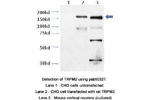 Image no. 2 for anti-Transient Receptor Potential Cation Channel, Subfamily M, Member 2 (TRPM2) (AA 1430-1508), (C-Term) antibody (ABIN363636) (TRPM2 antibody  (C-Term))