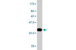 Western Blot detection against Immunogen (36. (PIK3R4 antibody  (AA 1259-1358))