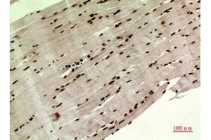 Immunohistochemistry (IHC) image for anti-WD Repeat Domain 83 (wdr83) (Internal Region) antibody (ABIN6281359)