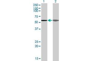 Western Blot analysis of AKAP5 expression in transfected 293T cell line by AKAP5 monoclonal antibody (M04), clone 1A9. (AKAP5 antibody  (AA 334-427))