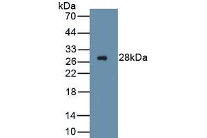 Detection of Recombinant ICAM2, Human using Polyclonal Antibody to Intercellular Adhesion Molecule 2 (ICAM2) (ICAM2 antibody  (AA 34-241))