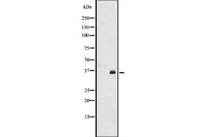 Western blot analysis of OR2A12 expression in CEM cell line lysates ,The lane on the left is treated with the antigen-specific peptide. (OR2A12 antibody  (C-Term))